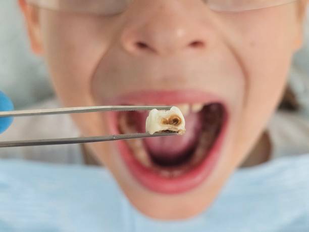 Best Emergency Dental Care for Abscessed Tooth in El Dorado, AR