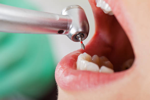 Best Pediatric Emergency Dentist in El Dorado, AR